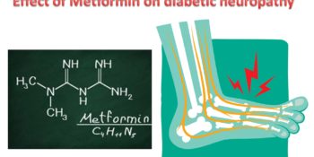 Diabetic Neuropathy and its Management